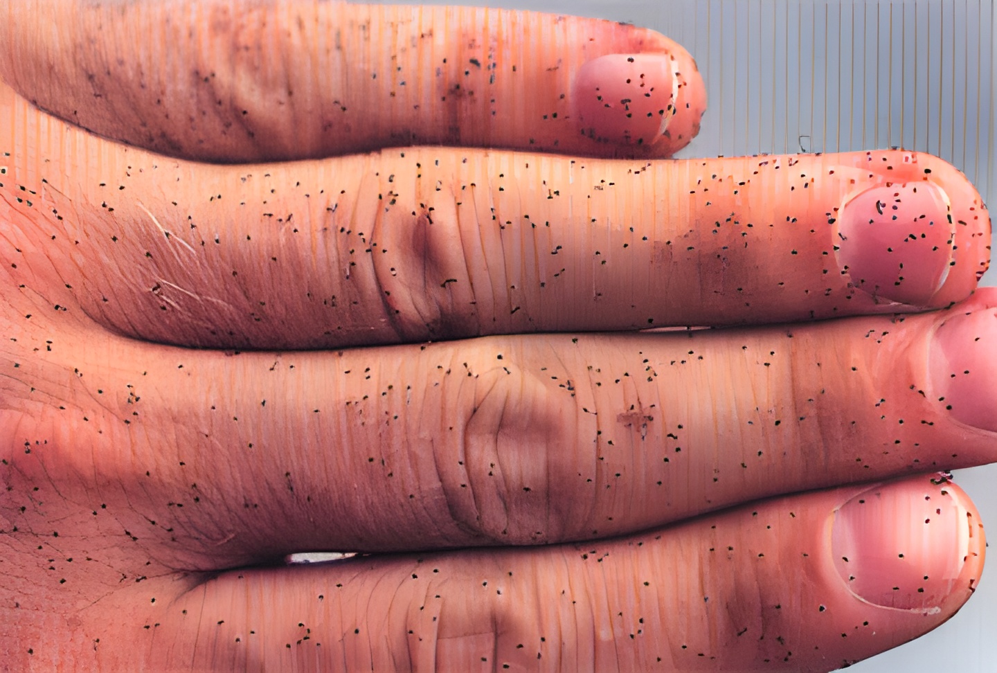 How Do I Get Rid of Mites on My Budgie? How to Treat Mites in Budgies?